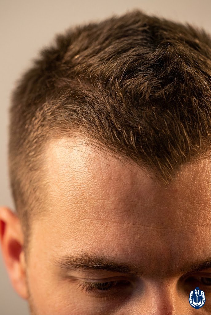 Long Buzz Cut With Widow’s Peak Detail